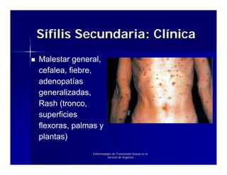 Sífilis Secundaria: Clínica
Malestar general,
cefalea, fiebre,
adenopatías
generalizadas,
Rash (tronco,
superficies
flexoras, palmas y
plantas)
               Enfermedades de Transmisión Sexual en el
                        Servicio de Urgencia
 