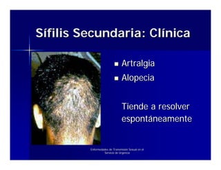 Sífilis Secundaria: Clínica

                                Artralgia
                                Alopecia


                                Tiende a resolver
                                espontáneamente


         Enfermedades de Transmisión Sexual en el
                  Servicio de Urgencia
 