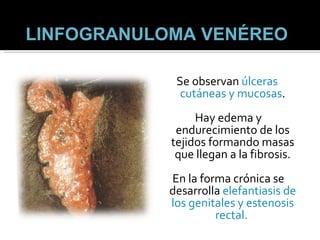 Se observan  úlceras cutáneas y mucosas . Hay edema y endurecimiento de los tejidos formando masas que llegan a la fibrosis. En la forma crónica se desarrolla  elefantiasis de los genitales y estenosis rectal.  LINFOGRANULOMA VENÉREO   