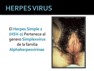 El  Herpes Simple 2 (HSV-2)  Pertenece al genero  Simplexvirus  de la familia  Alphaherpesvirinae   