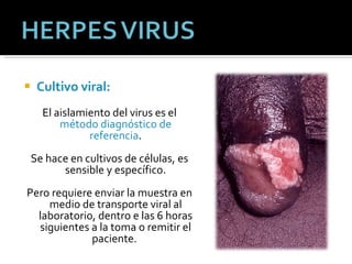 Cultivo viral: El aislamiento del virus es el  método diagnóstico de referencia . Se hace en cultivos de células, es sensible y específico. Pero requiere enviar la muestra en medio de transporte viral al laboratorio, dentro e las 6 horas siguientes a la toma o remitir el paciente.  