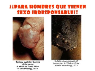¡¡PARA HOMBRES QUE TIENEN SEXO IRRESPONSABLE!! 