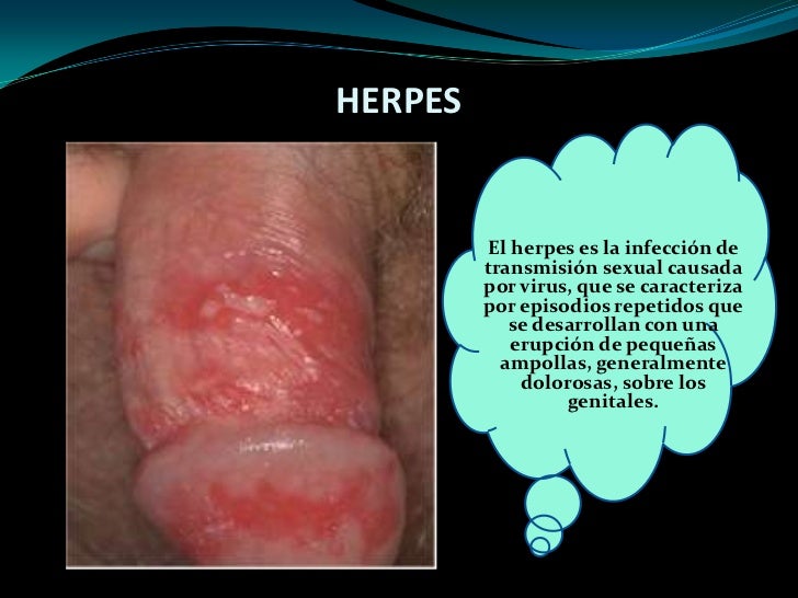 Sin daño aumentar el pene