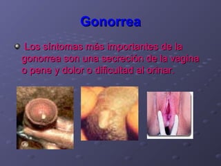 Gonorrea
Los síntomas más importantes de la
gonorrea son una secreción de la vagina
o pene y dolor o dificultad al orinar.
 