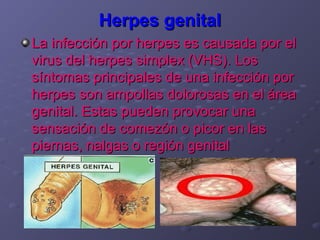 Herpes genital
La infección por herpes es causada por el
virus del herpes simplex (VHS). Los
síntomas principales de una infección por
herpes son ampollas dolorosas en el área
genital. Estas pueden provocar una
sensación de comezón o picor en las
piernas, nalgas o región genital
 