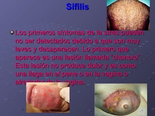 Sífilis

Los primeros síntomas de la sífilis pueden
no ser detectados debido a que son muy
leves y desaparecen. Lo primero que
aparece es una lesión llamada “chancro”.
Esta lesión no produce dolor y es como
una llaga en el pene o en la vagina o
alrededor de la vagina.
 
