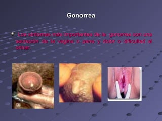 Gonorrea

 Los síntomas más importantes de la gonorrea son una
secreción de la vagina o pene y dolor o dificultad al
orinar.
 