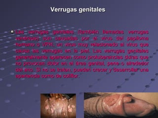 Verrugas genitales


Las verrugas genitales (también llamadas verrugas
venéreas) son causadas por el virus del papiloma
humano o VPH, un virus muy relacionado al virus que
causa las verrugas en la piel. Las verrugas genitales
generalmente aparecen como protuberancias duras que
no provocan dolor en el área genital, pene o alrededor
del ano. Si no se tratan, pueden crecer y desarrollar una
apariencia como de coliflor.
 