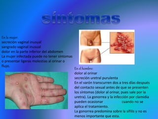 En el hombre:
dolor al orinar
secreción uretral purulenta
En el varón transcurren dos a tres días después
del contacto sexual antes de que se presenten
los síntomas (dolor al orinar, pues sale por la
uretra). La gonorrea y la infección por clamidia
pueden ocasionar esterilidad cuando no se
aplica el tratamiento.
La gonorrea predomina sobre la sífilis y no es
menos importante que esta.
En la mujer:
secreción vaginal inusual
sangrado vaginal inusual
dolor en la parte inferior del abdomen
La mujer infectada puede no tener síntomas
o presentar ligeras molestias al orinar o
flujo.
 