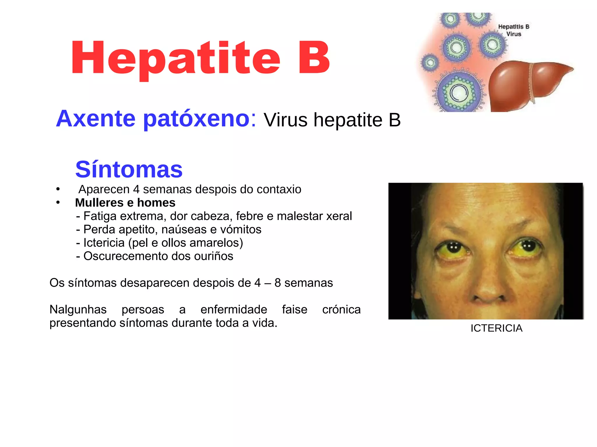 Hepatite B
Axente patóxeno: Virus hepatite B
Síntomas
●
Aparecen 4 semanas despois do contaxio
●
Mulleres e homes
- Fatiga extrema, dor cabeza, febre e malestar xeral
- Perda apetito, naúseas e vómitos
- Ictericia (pel e ollos amarelos)
- Oscurecemento dos ouriños
Os síntomas desaparecen despois de 4 – 8 semanas
Nalgunhas persoas a enfermidade faise crónica
presentando síntomas durante toda a vida. ICTERICIA
 
