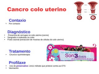 Cancro colo uterino
Contaxio
●
Por contacto
Diagnóstico
●
Presencia de verrugas no colo uterino (cervix)
●
Sangrado e molestias no coito
●
Frotis vaxinal (extracción de mostras de células do colo uterino)
Tratamento
●
Ciruxía e quimioterapia
Profilaxe
●
Uso de preservativo: único método que protexe contra as ETS
●
Vacinación
 