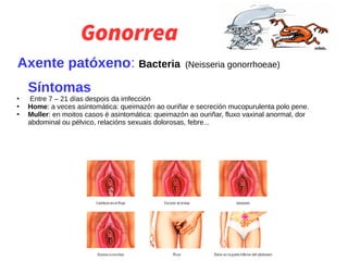 Gonorrea
Axente patóxeno: Bacteria (Neisseria gonorrhoeae)
Síntomas
●
Entre 7 – 21 días despois da imfección
●
Home: a veces asintomática: queimazón ao ouriñar e secreción mucopurulenta polo pene.
●
Muller: en moitos casos é asintomática: queimazón ao ouriñar, fluxo vaxinal anormal, dor
abdominal ou pélvico, relacións sexuais dolorosas, febre...
 