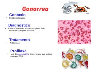 Gonorrea
Contaxio
●
Relacións sexuais
Diagnóstico
●
Cultivos e análises ao microscopio do fluxo
secretado polo pene e vaxina
Tratamento
●
Antibióticos
Profilaxe
●
Uso de preservativo: único método que protexe
contra as ETS
 