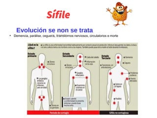 Sífile
Evolución se non se trata
●
Demencia, parálise, ceguera, transtornos nerviosos, circulatorios e morte
 
