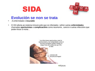 SIDA
Evolución se non se trata
●
A enfermidade e incurable
●
O VIH afecta ao sistema inmune polo que os infectados sofren outras enfermidades
chamadas oportunistas e complicacións como neumonía , cancro e outras infeccións que
poden levar á morte .
 