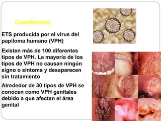 Condilomas
ETS producida por el virus del
papiloma humano (VPH)
Existen más de 100 diferentes
tipos de VPH. La mayoría de los
tipos de VPH no causan ningún
signo o síntoma y desaparecen
sin tratamiento
Alrededor de 30 tipos de VPH se
conocen como VPH genitales
debido a que afectan el área
genital

 