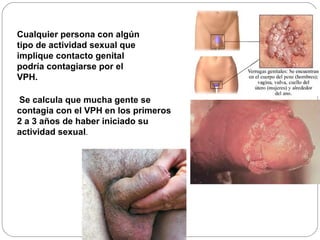Cualquier persona con algún
tipo de actividad sexual que
implique contacto genital
podría contagiarse por el
VPH.
Se calcula que mucha gente se
contagia con el VPH en los primeros
2 a 3 años de haber iniciado su
actividad sexual.

 