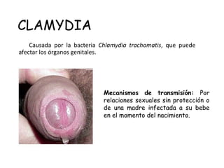 CLAMYDIA
Causada por la bacteria Chlamydia trachomatis, que puede
afectar los órganos genitales.
Mecanismos de transmisión: Por
relaciones sexuales sin protección o
de una madre infectada a su bebe
en el momento del nacimiento.
 