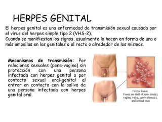 HERPES GENITAL
El herpes genital es una enfermedad de transmisión sexual causada por
el virus del herpes simple tipo 2 (VHS-2).
Cuando se manifiestan los signos, usualmente lo hacen en forma de una o
más ampollas en los genitales o el recto o alrededor de los mismos.
Mecanismos de transmisión: Por
relaciones sexuales (pene-vagina) sin
protección con una persona
infectada con herpes genital o por
contacto sexual oral-genital al
entrar en contacto con la saliva de
una persona infectada con herpes
genital oral.
 