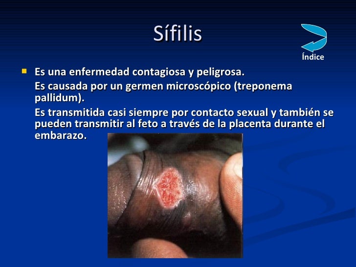 Zosterin las ultras 60 a la psoriasis