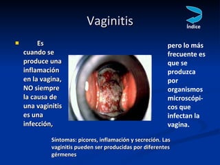 Vaginitis <ul><li>Es cuando se produce una inflamación en la vagina, NO siempre la causa de una vaginitis es una infección...