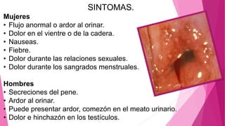 SINTOMAS.
Mujeres
• Flujo anormal o ardor al orinar.
• Dolor en el vientre o de la cadera.
• Nauseas.
• Fiebre.
• Dolor durante las relaciones sexuales.
• Dolor durante los sangrados menstruales.
Hombres
• Secreciones del pene.
• Ardor al orinar.
• Puede presentar ardor, comezón en el meato urinario.
• Dolor e hinchazón en los testículos.
 