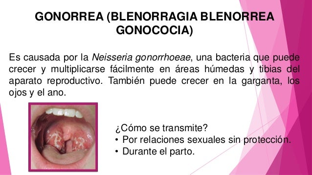 ets sintomas en hombres ets sintomas en hombres