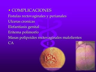 • COMPLICACIONES
Fistulas rectovaginales y perianales
Ulceras cronicas
Elefantiasis genital
Eritema polimorfo
Masas polipoides rectovaginales malolientes
CA
 