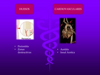 HUESOS        CARDIOVASCULARES




• Periostitis
• Zonas           • Aortitis
  destructivas    • Insuf Aortica
 