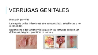 VERRUGAS GENITALES
Infección por VPH
La mayoría de las infecciones son asintomáticas, subclínicas o no
reconocidas
Dependiendo del tamaño y localización las verrugas pueden ser
dolorosas, frágiles, pruríticas o las tres
 