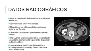 DATOS RADIOGRÁFICOS
Aspecto “apolillado” de los cálices ulcerados con
afectación;
Obliteración de uno o más cálices;
Dilatación de los cálices debida a estenosis
ureteral por fibrosis;
Cavidades del absceso que conectan con los
cálices;
Una o varias estenosis ureterales, con dilatación
secundaria, acortamiento y, por tanto, disposición
recta del uréter, y
La ausencia de función del riñón debida a
oclusión ureteral completa y destrucción renal
(autonefrectomía)
 
