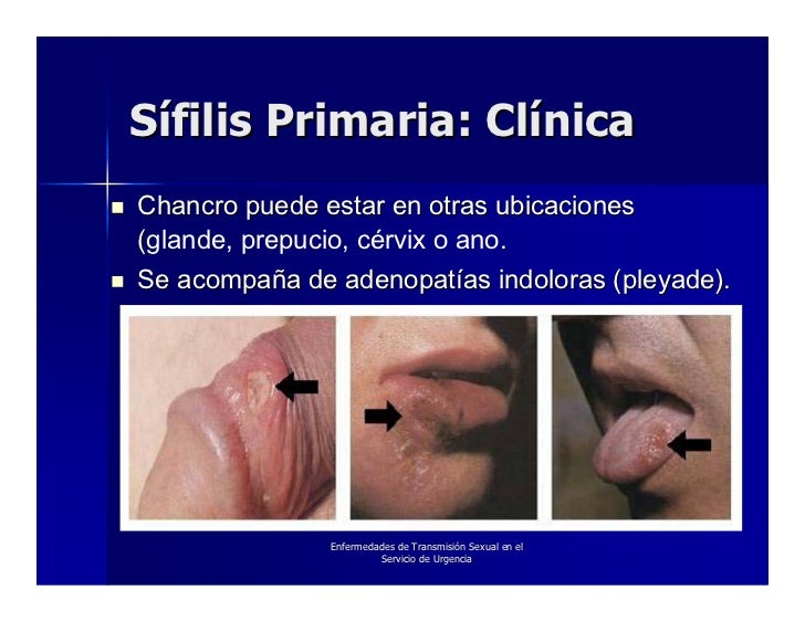 De la crema la dimensión que aumenta del miembro