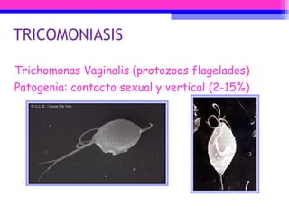 TRICOMONIASIS Trichomonas Vaginalis (protozoos flagelados) Patogenia: contacto sexual y vertical (2-15%) 