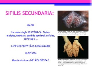 RASH Sintomatología SISTÉMICA: Fiebre, mialgias, anorexia, pérdida ponderal, cefalea, odinofagia, … LINFADENOPATÍAS Generalizadas ALOPECIA Manifestaciones NEUROLÓGICAS SIFILIS SECUNDARIA: 
