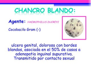 Agente:   HAEMOPHILUS DUCREYI Cocobacilo Gram (-) ulcera genital, dolorosa con bordes blandos, asociada en el 50% de casos a adenopatia inguinal supurativa. Transmitido por contacto sexual 