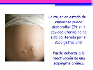 La mujer en estado de embarazo puede desarrollar EPI si la cavidad uterina no ha sido obliterada por el saco gestacional Puede deberse a la reactivación de una salpingitis crónica 