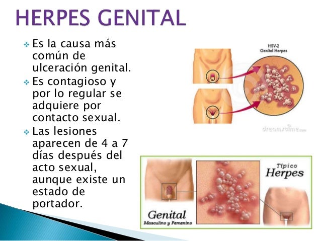 Si es posible sanar la hernia en el departamento de pecho