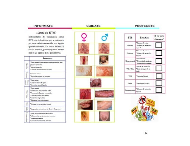 Enfermedades de Transmicion Sexual, Proyecto