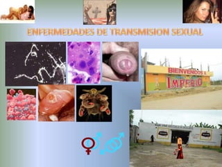 ENFERMEDADES DE TRANSMISION SEXUAL 