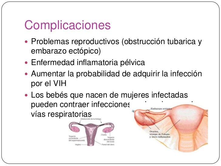 Ets vulvovaginitis uretritis y cervicitis Ets vulvovaginitis uretritis y cervicitis