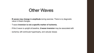 Other Waves
• R waves may change in amplitude during exercise. There is no diagnostic
value in these changes.
• T-wave inversion is not a specific marker of ischemia.
• If the U wave is upright at baseline, U-wave inversion may be associated with
• ischemia, left ventricular hypertrophy, and valvular diseas
 