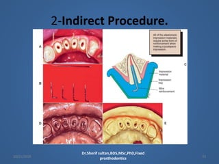 restoration of endodontically treated teeth cast post | PPTX