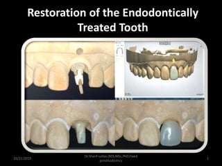 Restoration of the Endodontically
Treated Tooth
10/21/2019
Dr.Sherif sultan,BDS,MSc,PhD,Fixed
prosthodontics
1
 