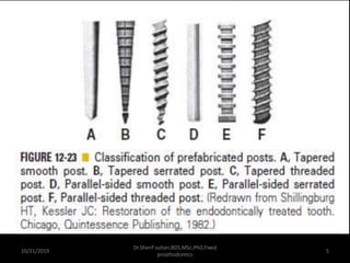 Pre Tapped Posts restoration of endodontically treated teeth ready post | PPTX