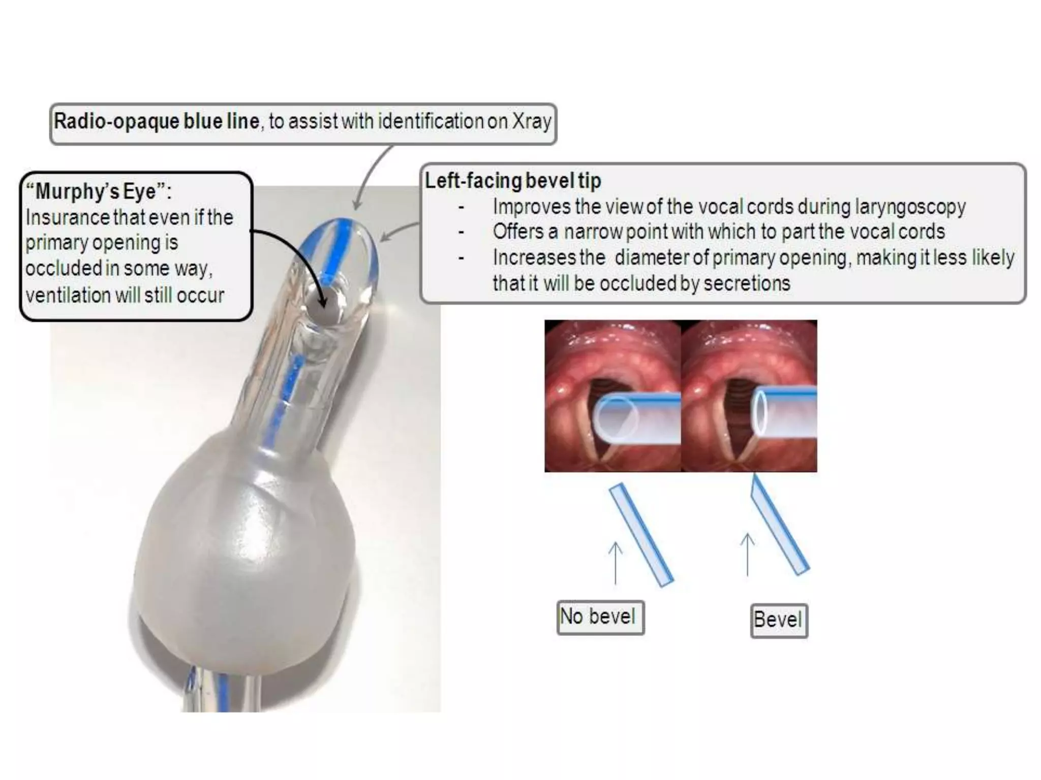 Endotracheal Tube and Laryngeal Mask Airway | PPTX