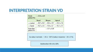 INTERPRETATION STRAIN VD
Sa valeur normale : − 25 à − 30 % (valeur moyenne − 24 ± 5 %).
Dysfonction VD si SL<20%
 