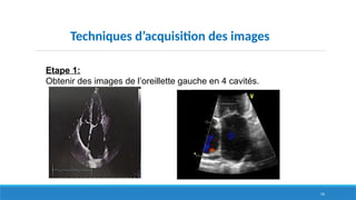 56
Techniques d’acquisition des images
Etape 1:
Obtenir des images de l’oreillette gauche en 4 cavités.
 