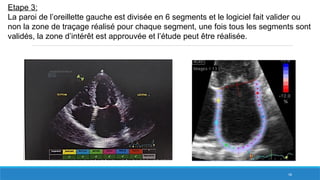 58
Etape 3:
La paroi de l’oreillette gauche est divisée en 6 segments et le logiciel fait valider ou
non la zone de traçage réalisé pour chaque segment, une fois tous les segments sont
validés, la zone d’intérêt est approuvée et l’étude peut être réalisée.
 