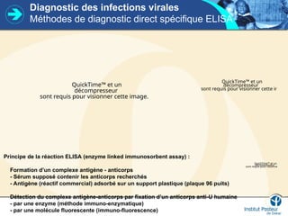 Diagnostic des infections virales
Méthodes de diagnostic direct spécifique ELISA
QuickTime™ et un
décompresseur
sont requis pour visionner cette image.
QuickTime™ et un
décompresseur
sont requis pour visionner cette image.
Principe de la réaction ELISA (enzyme linked immunosorbent assay) :
Formation d’un complexe antigène - anticorps
- Sérum supposé contenir les anticorps recherchés
- Antigène (réactif commercial) adsorbé sur un support plastique (plaque 96 puits)
Détection du complexe antigène-anticorps par fixation d’un anticorps anti-U humaine
- par une enzyme (méthode immuno-enzymatique)
- par une molécule fluorescente (immuno-fluorescence)
QuickTime™ et un
décompresseur
sont requis pour visionner cette im
 