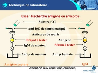 Technique de laboratoire
Elisa : Recherche antigène ou anticorps
Elisa : Recherche antigène ou anticorps
Anti IgG de souris marqué
Anticorps de souris
IgM de mouton Sérum à tester
Broyat à tester Antigène
Anti µ de mouton Anti µ humain
Antigène capture IgM
Substrat OT
Attention aux réactions croisées
Attention aux réactions croisées
 